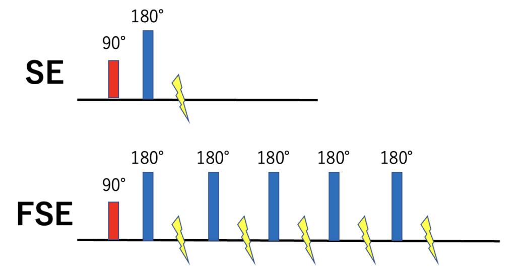 高速スピンエコーfse Fast Spin Echo について 大学病院から教わるmriの世界
